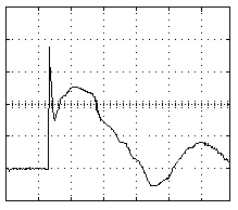 esd graph